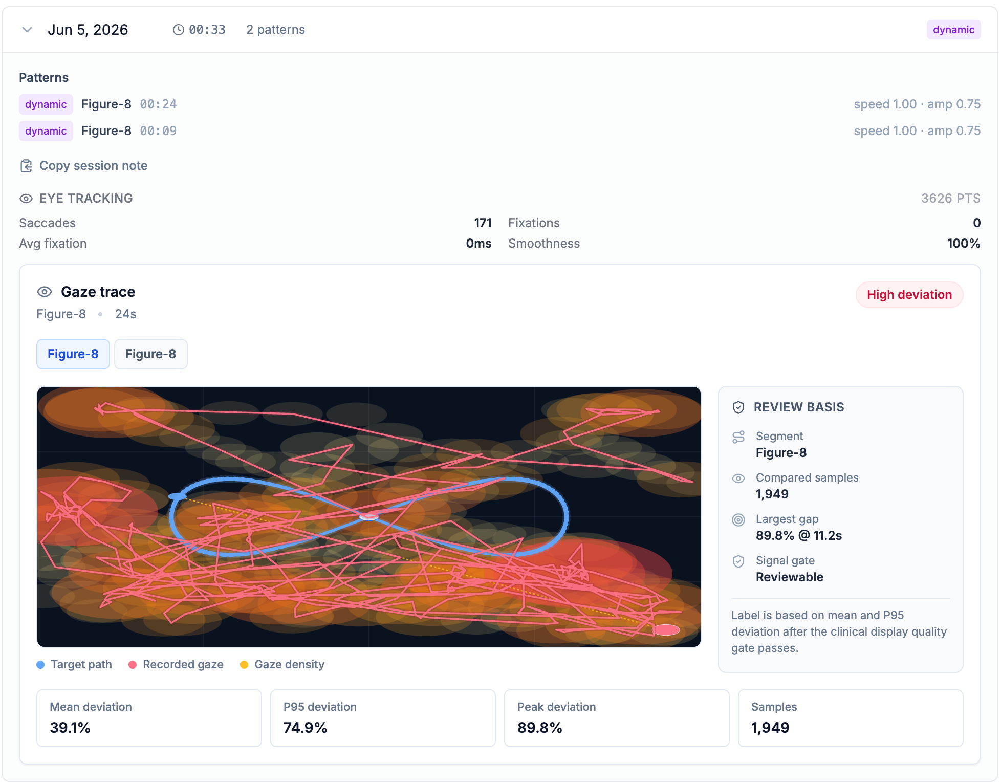 Introducing Gaze Trace Review for In-Clinic Visual Therapy